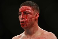 diego-sanchez-face-cut-bj-penn-ufc-107.jpg